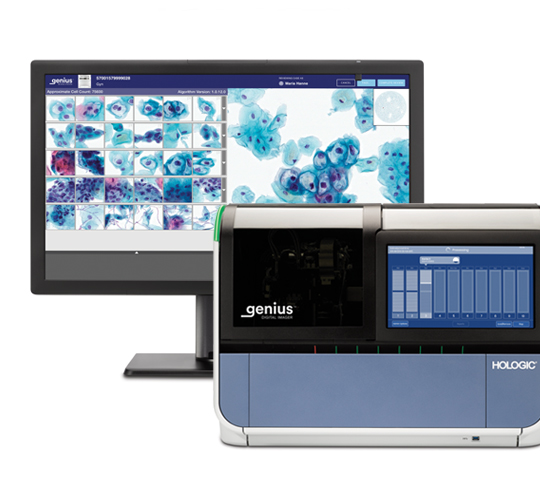 Genius™ Digital Diagnostics System d’Hologic sur fond blanc