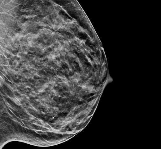 Imagerie 2D synthétique C-View™ d’Hologic sur fond blanc