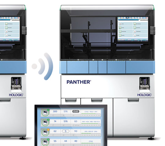 Image du Panther® Link d’Hologic sur fond blanc