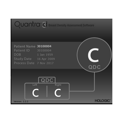 Technologie Quantra™ d’Hologic sur fond blanc