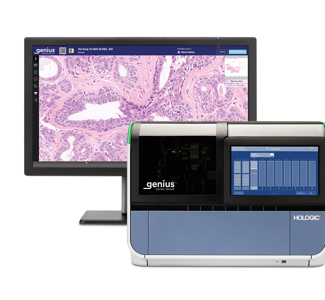 Genius Digital Diagnostics Imager et écran affichant les cellules du col de l’utérus