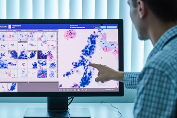 Professionnel de la santé regardant les images d’un scanner sur un écran