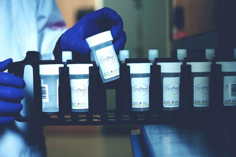 Main gantée retirant un échantillon d’un plateau