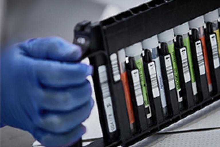 Main gantée tenant un rack de flacons