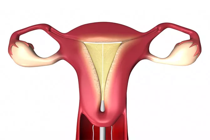 Illustration sur fond blanc