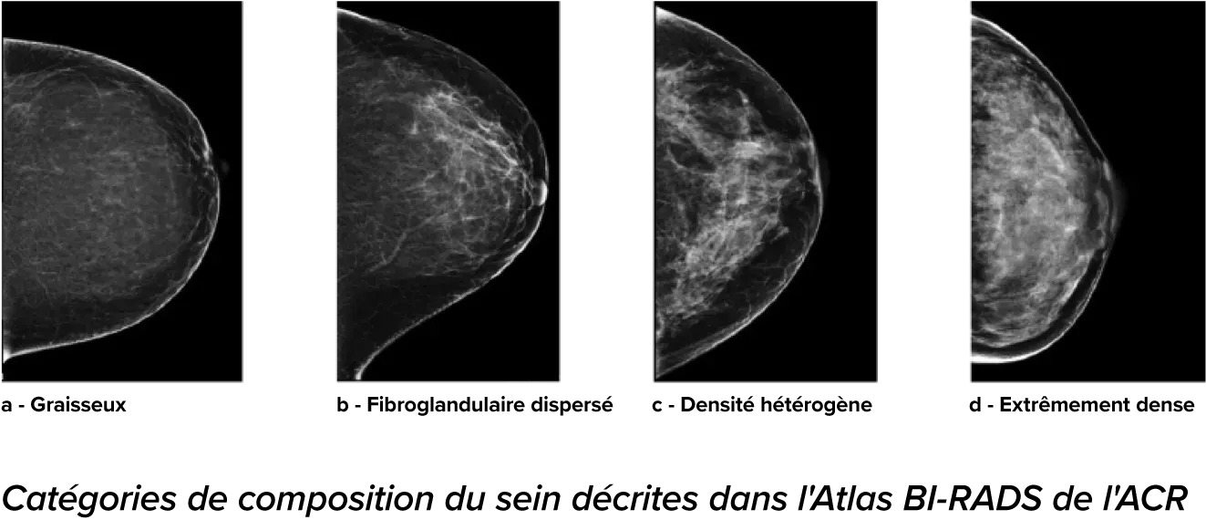 Images de mammographies