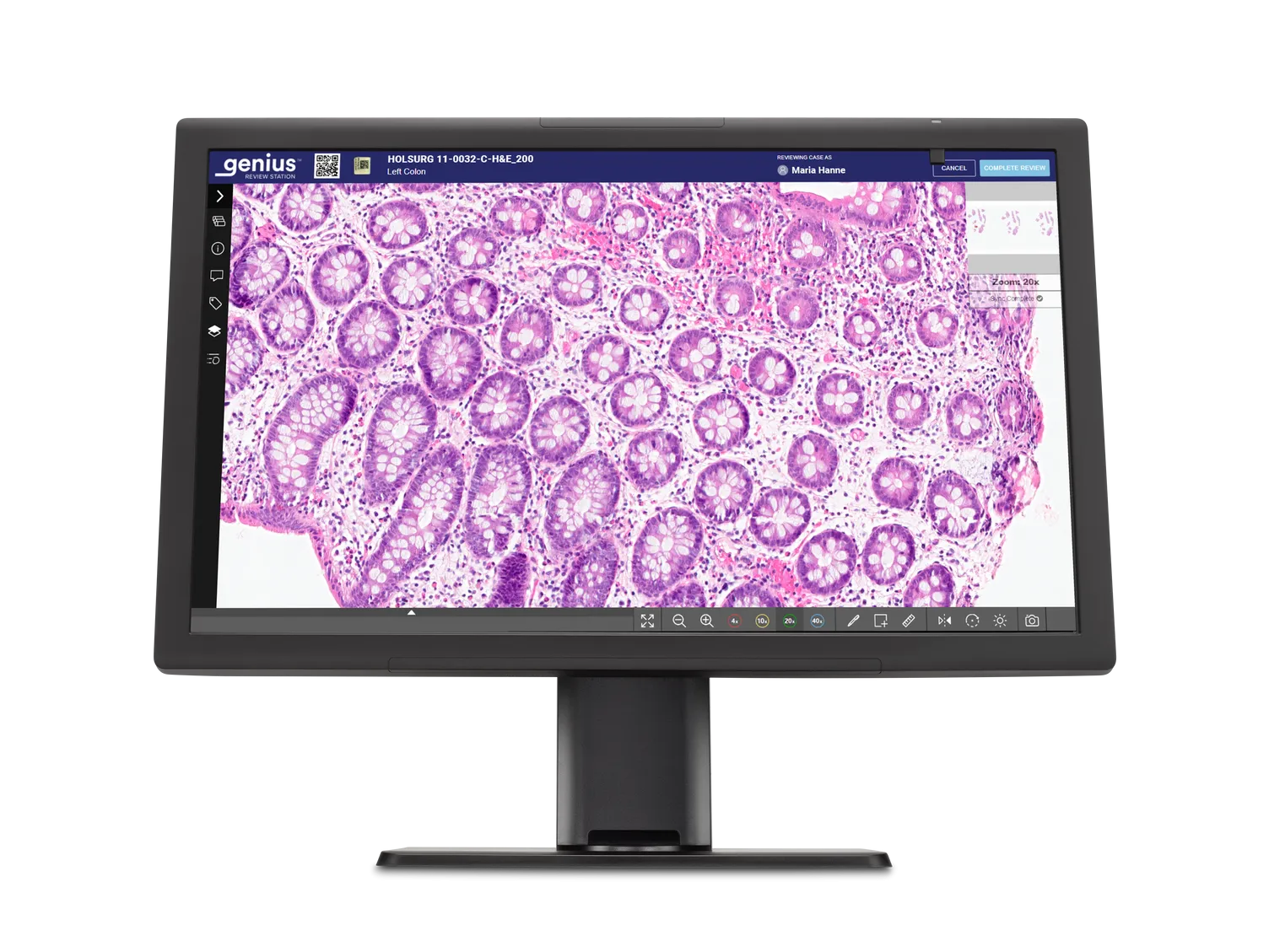 Écran Genius affichant les cellules histologiques prêtes à être examinées