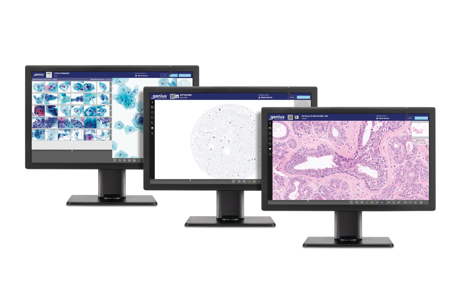 3 écrans Genius affichent des lames d’histologie et de cytologie prêtes à être examinées.