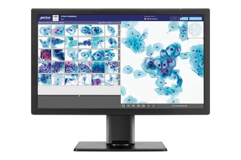 Écran Genius affichant les cellules cytologiques prêtes à être examinées