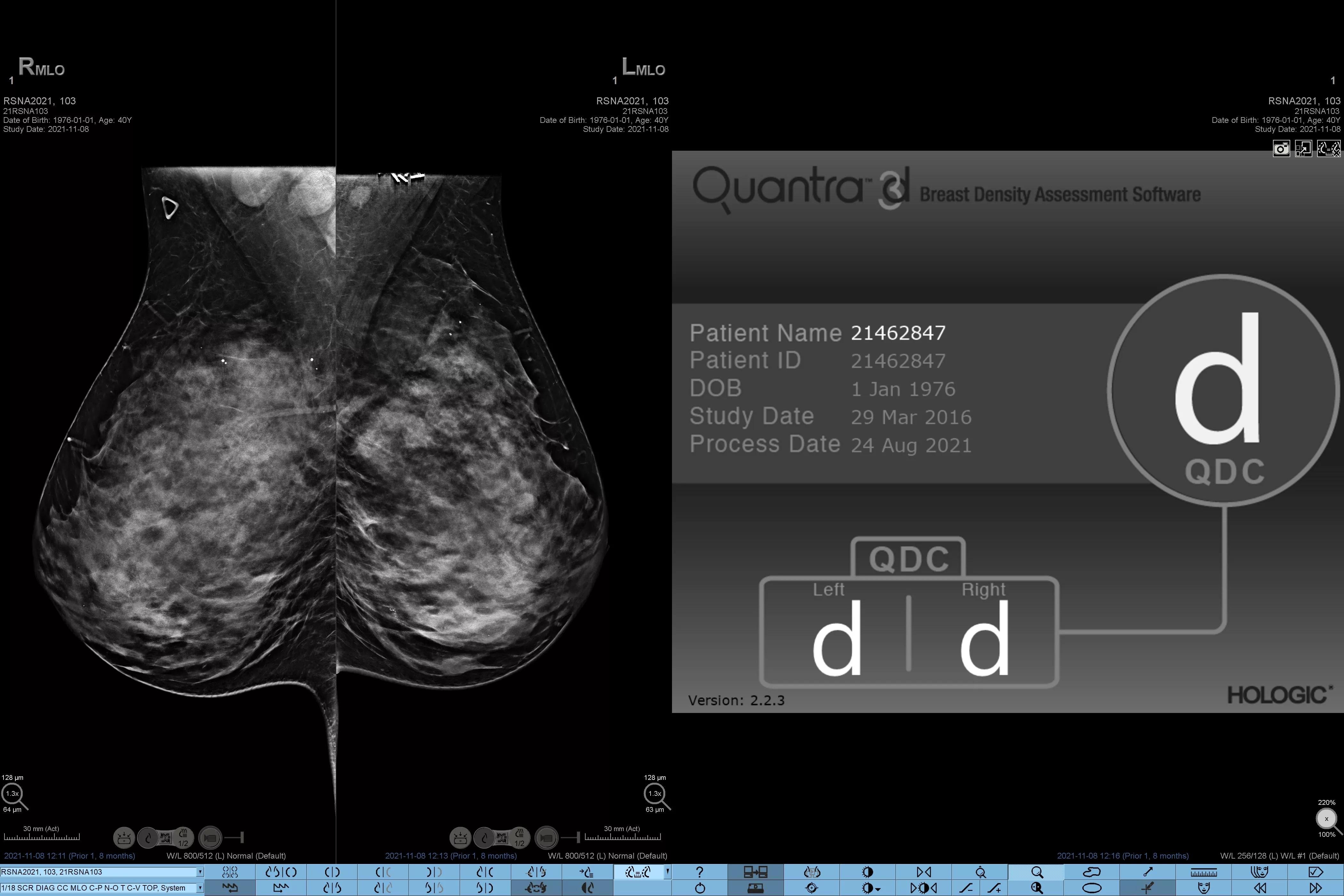 Image de radiographie