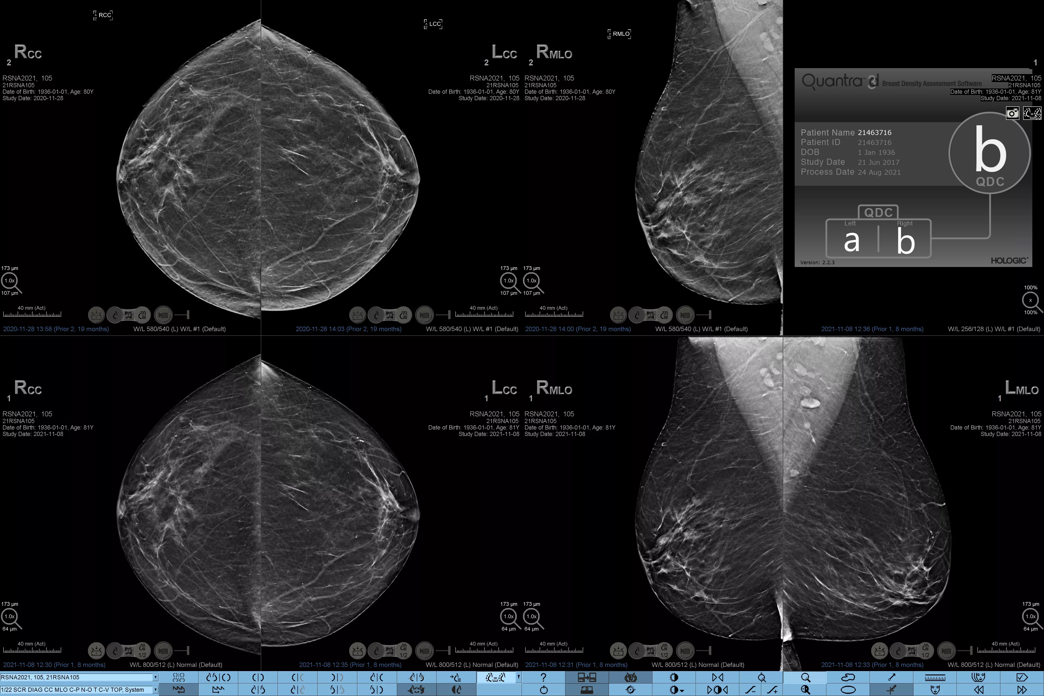 Sonde L18-5 sur fond blanc