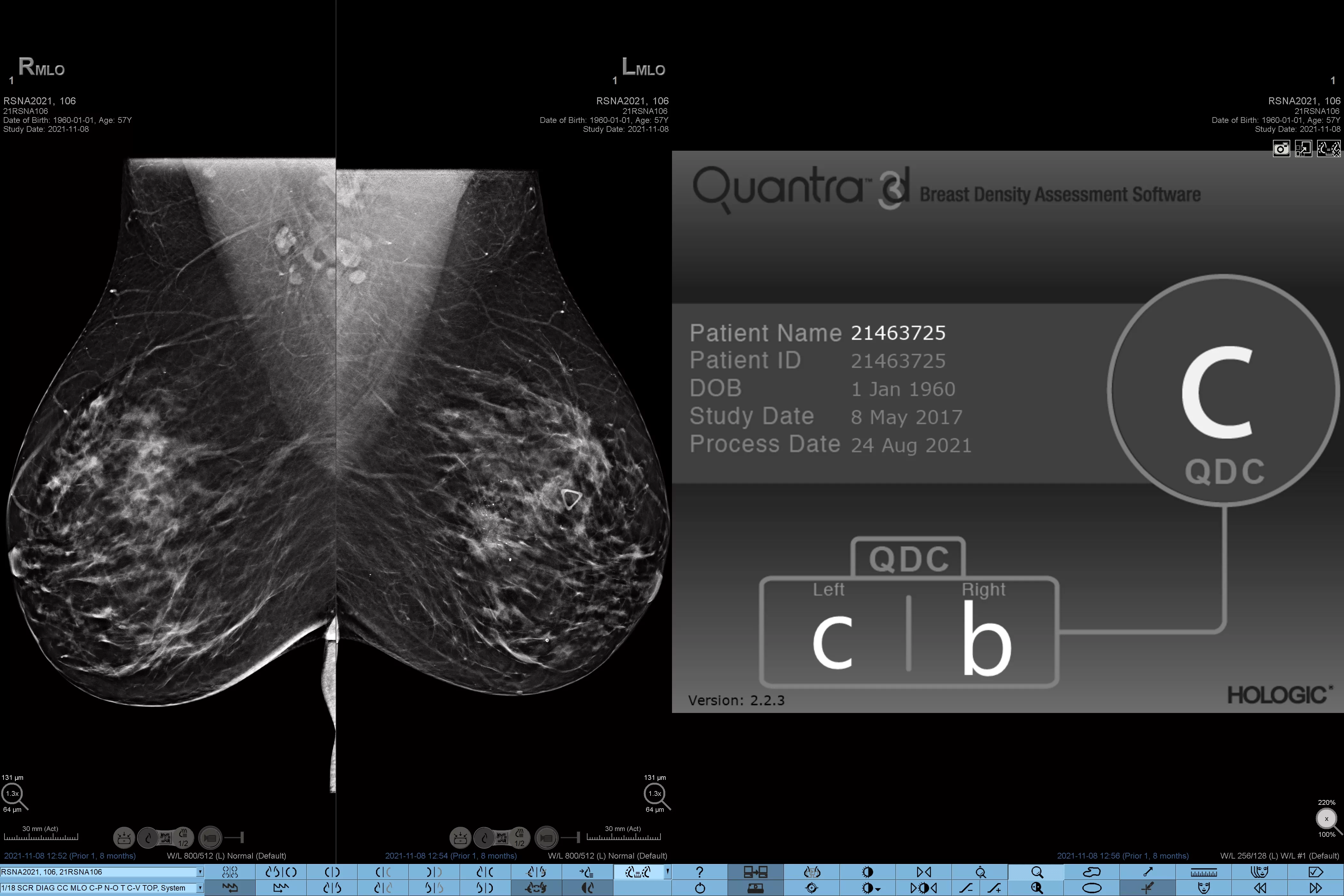 Image de radiographie