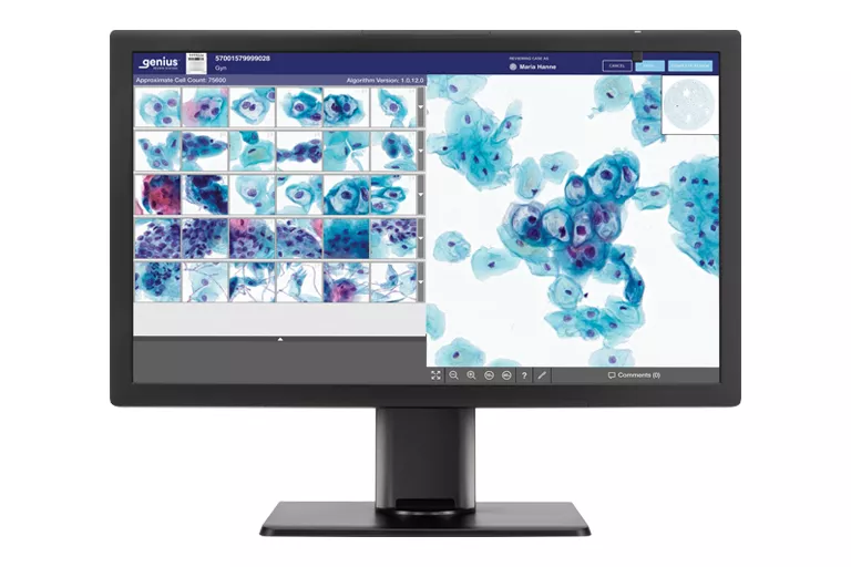 Image d’un moniteur Genius