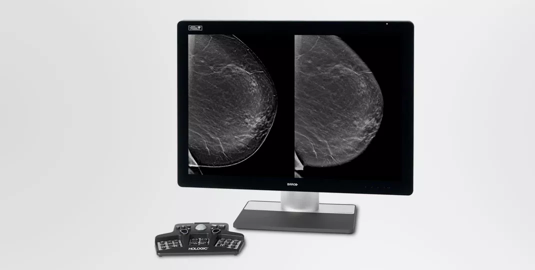 Radiographie du sein