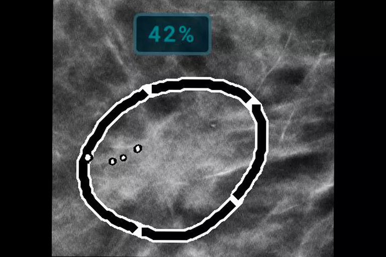 image de radiographie