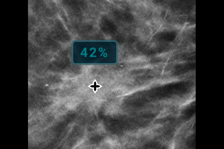 image de radiographie