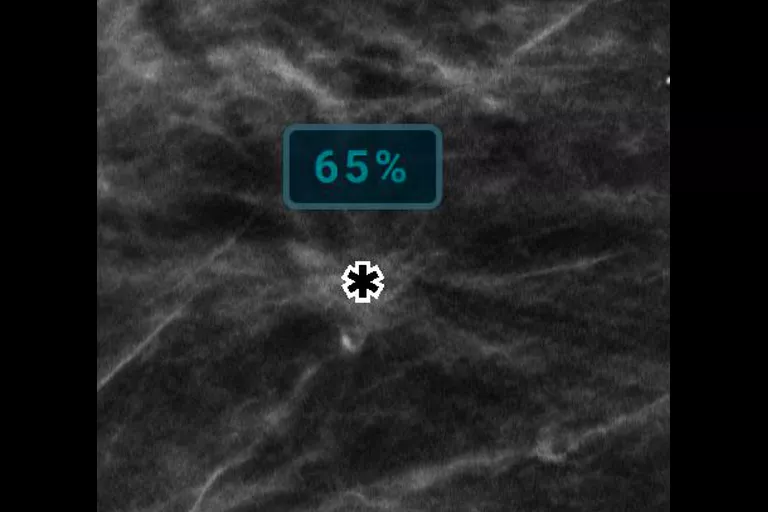 image de radiographie
