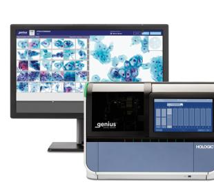 Genius™ Digital Diagnostics System d’Hologic sur fond blanc