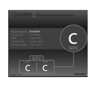 Technologie Quantra™ d’Hologic sur fond blanc