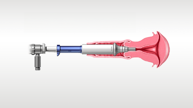 Illustration d’un dispositif médical en cours d’utilisation